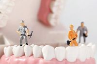 【健康解碼】洗牙會損害牙齒嗎？